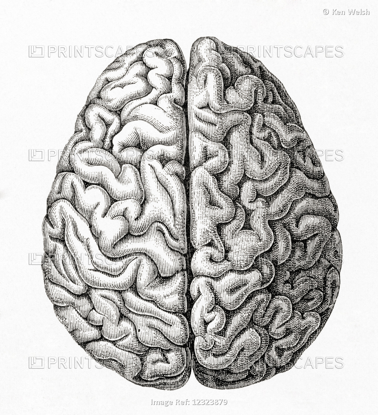 Diagram Of The Human Cerebellum Seen From Above.  From Meyers Lexicon, ...